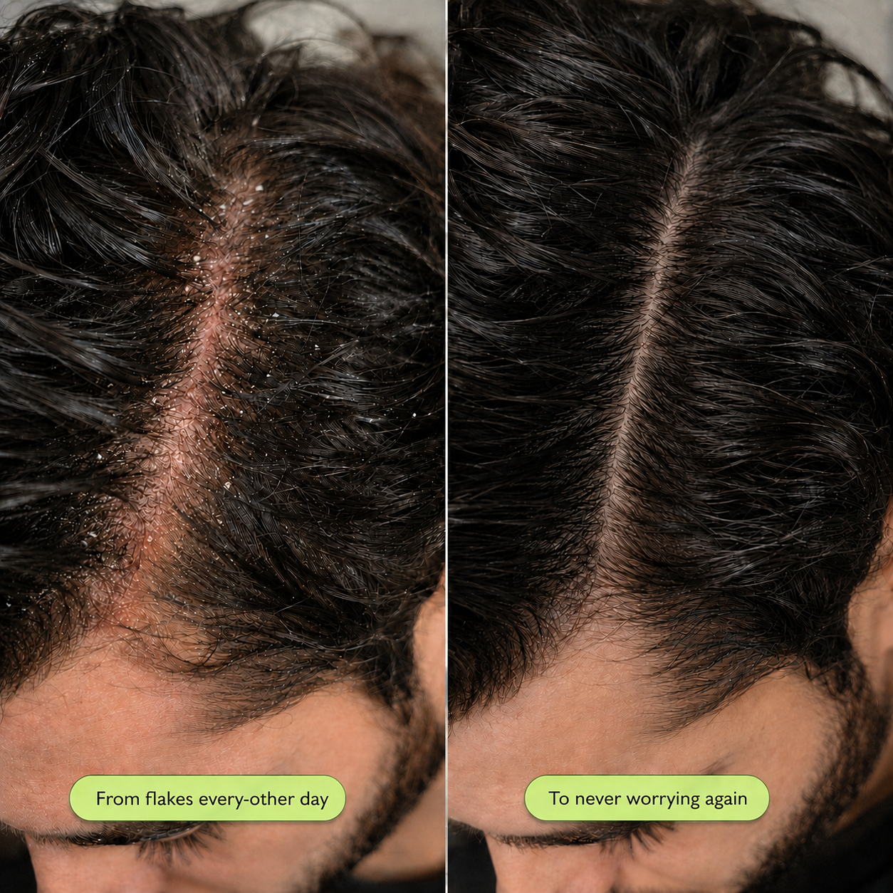 Scalp Reset Shampoo