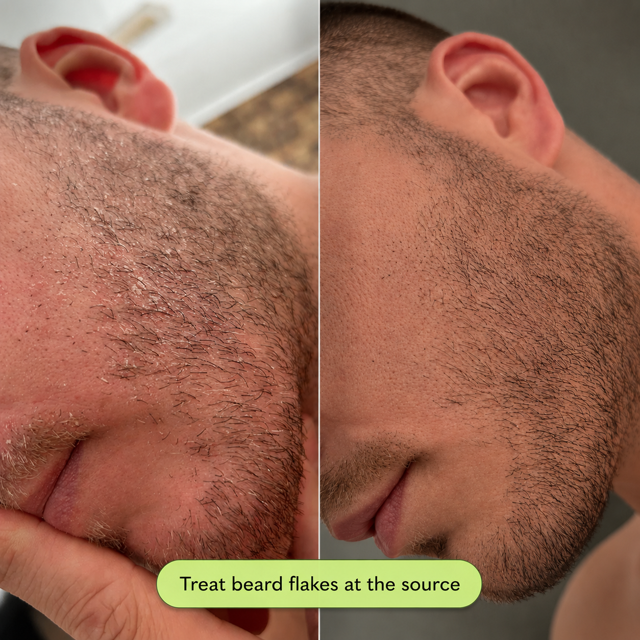Scalp Reset Shampoo