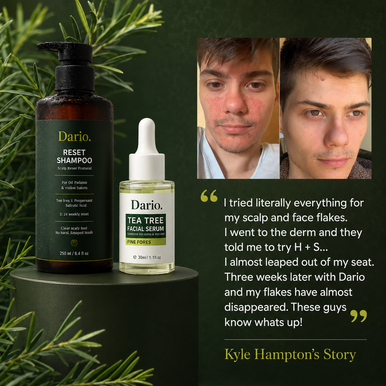 Scalp Reset Shampoo