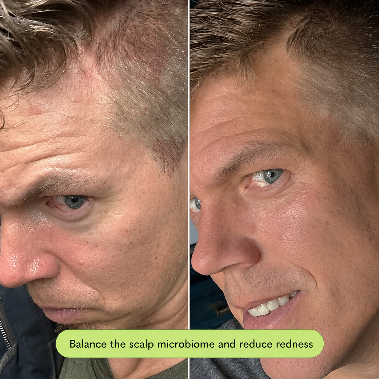Flake Calming Serum
