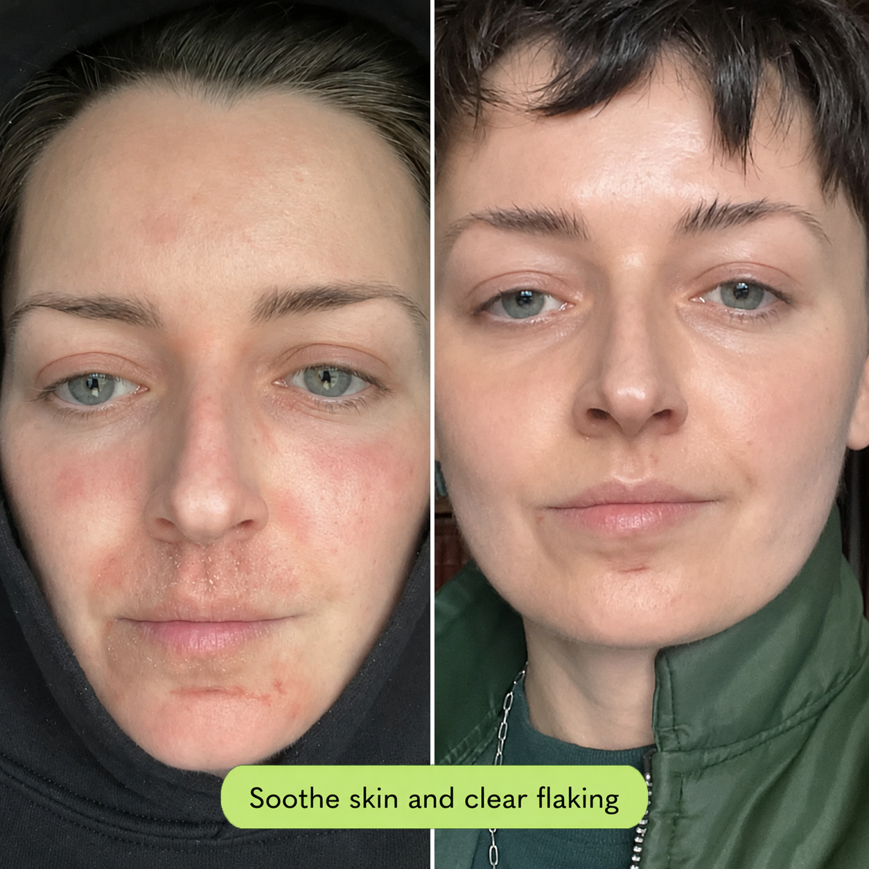 Flake Calming Serum