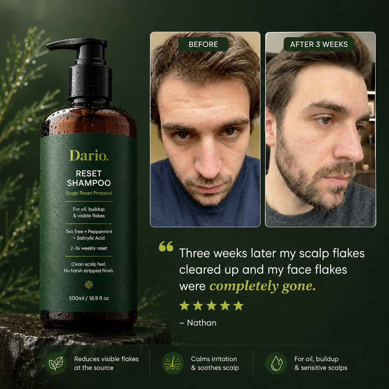 Scalp Reset Shampoo